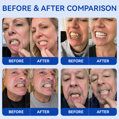 🇺🇸𝑮𝒍𝒊𝒎𝒎𝒆𝒓𝒍𝒚® 🦷𝑮𝒖𝒎𝑹𝒆𝒗𝒊𝒗𝒆 𝒑𝒆𝒓𝒊𝒐𝒅𝒐𝒏𝒕𝒂𝒍 𝒓𝒆𝒑𝒂𝒊𝒓 𝒈𝒆𝒍🍀