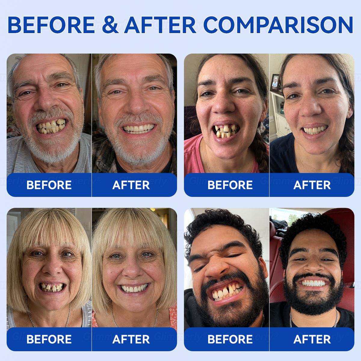 🇺🇸𝑮𝒍𝒊𝒎𝒎𝒆𝒓𝒍𝒚® 🦷𝑮𝒖𝒎𝑹𝒆𝒗𝒊𝒗𝒆 𝒑𝒆𝒓𝒊𝒐𝒅𝒐𝒏𝒕𝒂𝒍 𝒓𝒆𝒑𝒂𝒊𝒓 𝒈𝒆𝒍🍀