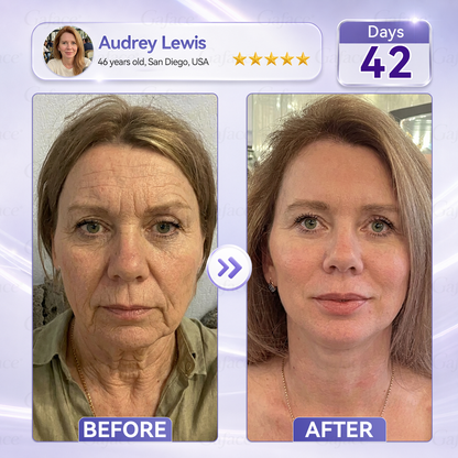 𝐆𝐚𝐟𝐚𝐜𝐞® 𝐂𝐨𝐥𝐥𝐚𝐠𝐞𝐧 & 𝐅𝐮𝐥𝐥𝐞𝐫𝐞𝐧𝐞 𝐑𝐨𝐥𝐥𝐞𝐫 𝐅𝐢𝐫𝐦𝐢𝐧𝐠 𝐂𝐫𝐞𝐚𝐦⏰Enjoy an exclusive 30% discount⏰