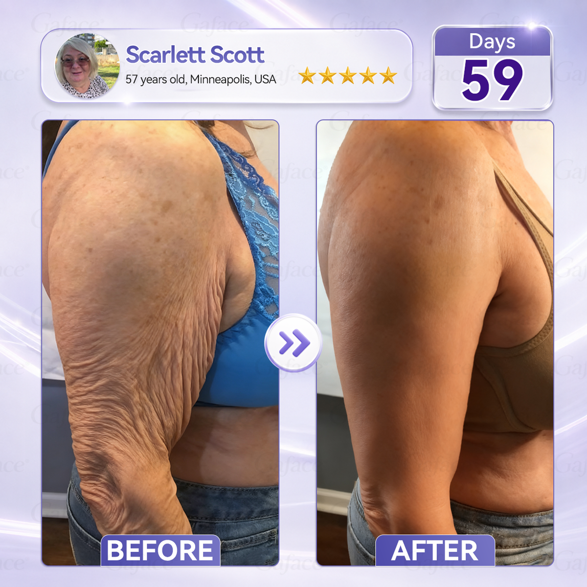 𝐆𝐚𝐟𝐚𝐜𝐞® 𝐂𝐨𝐥𝐥𝐚𝐠𝐞𝐧 & 𝐅𝐮𝐥𝐥𝐞𝐫𝐞𝐧𝐞 𝐑𝐨𝐥𝐥𝐞𝐫 𝐅𝐢𝐫𝐦𝐢𝐧𝐠 𝐂𝐫𝐞𝐚𝐦⏰Enjoy an exclusive 30% discount⏰