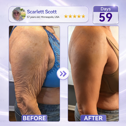 𝐆𝐚𝐟𝐚𝐜𝐞® 𝐂𝐨𝐥𝐥𝐚𝐠𝐞𝐧 & 𝐅𝐮𝐥𝐥𝐞𝐫𝐞𝐧𝐞 𝐑𝐨𝐥𝐥𝐞𝐫 𝐅𝐢𝐫𝐦𝐢𝐧𝐠 𝐂𝐫𝐞𝐚𝐦⏰Enjoy an exclusive 30% discount⏰