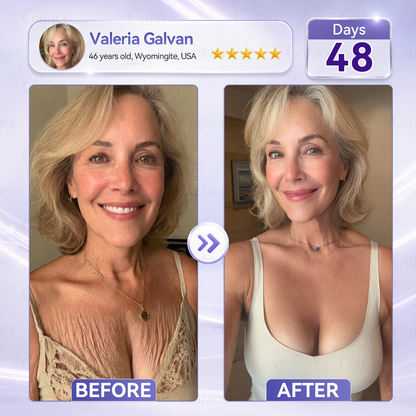 𝐆𝐚𝐟𝐚𝐜𝐞® 𝐂𝐨𝐥𝐥𝐚𝐠𝐞𝐧 & 𝐅𝐮𝐥𝐥𝐞𝐫𝐞𝐧𝐞 𝐑𝐨𝐥𝐥𝐞𝐫 𝐅𝐢𝐫𝐦𝐢𝐧𝐠 𝐂𝐫𝐞𝐚𝐦⏰Enjoy an exclusive 30% discount⏰
