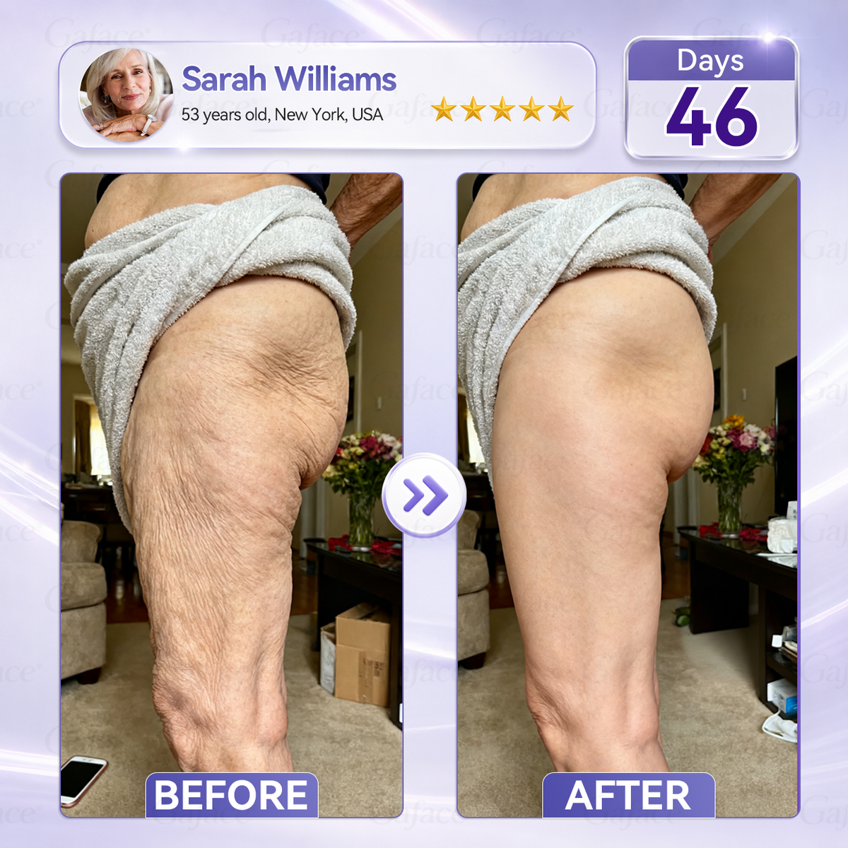 𝐆𝐚𝐟𝐚𝐜𝐞® 𝐂𝐨𝐥𝐥𝐚𝐠𝐞𝐧 & 𝐅𝐮𝐥𝐥𝐞𝐫𝐞𝐧𝐞 𝐑𝐨𝐥𝐥𝐞𝐫 𝐅𝐢𝐫𝐦𝐢𝐧𝐠 𝐂𝐫𝐞𝐚𝐦⏰Enjoy an exclusive 30% discount⏰