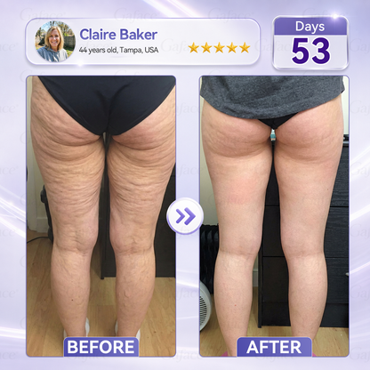 𝐆𝐚𝐟𝐚𝐜𝐞® 𝐂𝐨𝐥𝐥𝐚𝐠𝐞𝐧 & 𝐅𝐮𝐥𝐥𝐞𝐫𝐞𝐧𝐞 𝐑𝐨𝐥𝐥𝐞𝐫 𝐅𝐢𝐫𝐦𝐢𝐧𝐠 𝐂𝐫𝐞𝐚𝐦⏰Enjoy an exclusive 30% discount⏰