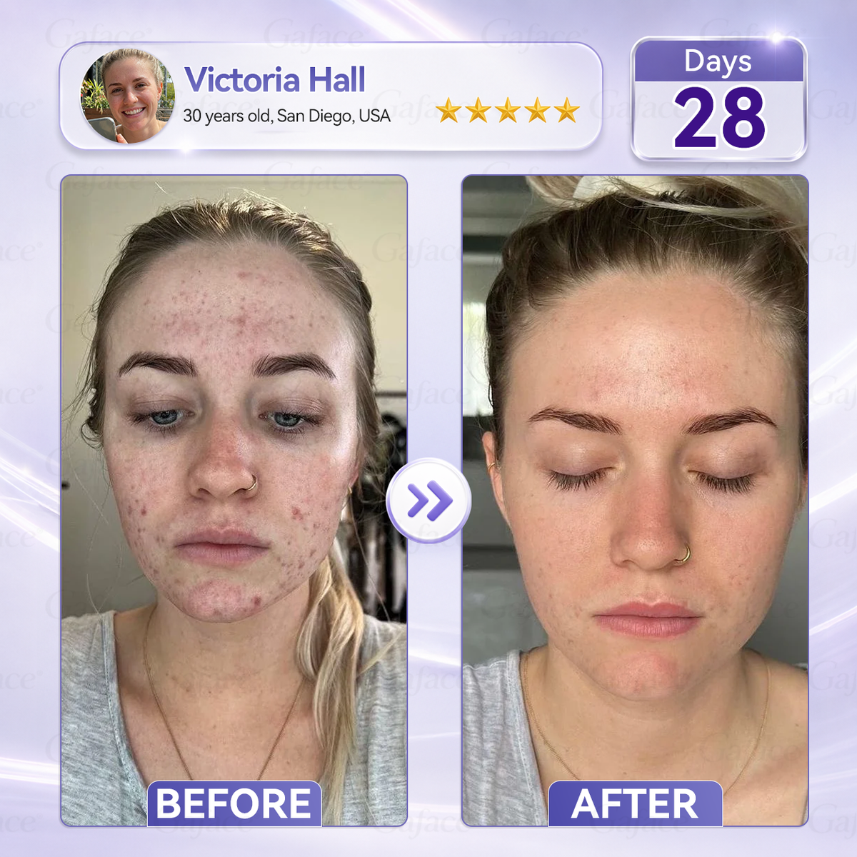 𝐆𝐚𝐟𝐚𝐜𝐞® 𝐂𝐨𝐥𝐥𝐚𝐠𝐞𝐧 & 𝐅𝐮𝐥𝐥𝐞𝐫𝐞𝐧𝐞 𝐑𝐨𝐥𝐥𝐞𝐫 𝐅𝐢𝐫𝐦𝐢𝐧𝐠 𝐂𝐫𝐞𝐚𝐦⏰Enjoy an exclusive 30% discount⏰