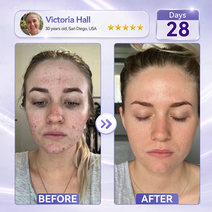 𝐆𝐚𝐟𝐚𝐜𝐞® 𝐂𝐨𝐥𝐥𝐚𝐠𝐞𝐧 & 𝐅𝐮𝐥𝐥𝐞𝐫𝐞𝐧𝐞 𝐑𝐨𝐥𝐥𝐞𝐫 𝐅𝐢𝐫𝐦𝐢𝐧𝐠 𝐂𝐫𝐞𝐚𝐦⏰Enjoy an exclusive 30% discount⏰
