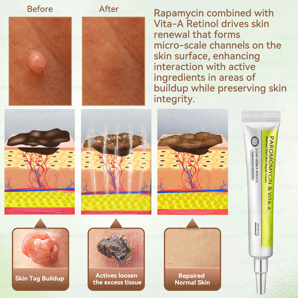 𝐺𝑙𝑖𝑚𝑚𝑒𝑟𝑙𝑦® 👩‍⚕️𝑃𝑎𝑟𝑜𝑚𝑜𝑚𝑦𝑐𝑖𝑛 & 𝑉𝑖𝑡𝑎-𝑎 𝑅𝑒𝑡𝑖𝑛𝑜𝑙 𝑆ℎ𝑜𝑡 𝑆𝑘𝑖𝑛 𝑅𝑒𝑝𝑎𝑖𝑟 𝐶𝑟𝑒𝑎𝑚（𝐖𝐢𝐭𝐡 𝐋𝐢𝐪𝐮𝐢𝐝 𝐌𝐢𝐜𝐫𝐨𝐧𝐞𝐞𝐝𝐥𝐞𝐬, 𝐆𝐞𝐧𝐭𝐥𝐲 𝐆𝐞𝐭𝐬 𝐑𝐢𝐝 𝐎𝐟 𝐖𝐚𝐫𝐭𝐬, 𝐌𝐨𝐥𝐞𝐬, 𝐀𝐠𝐞 𝐒𝐩𝐨𝐭𝐬, 𝐀𝐧𝐝 𝐒𝐤𝐢𝐧 𝐓𝐚𝐠𝐬 ）🪄