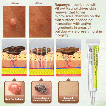 𝐺𝑙𝑖𝑚𝑚𝑒𝑟𝑙𝑦® 👩‍⚕️𝑃𝑎𝑟𝑜𝑚𝑜𝑚𝑦𝑐𝑖𝑛 & 𝑉𝑖𝑡𝑎-𝑎 𝑅𝑒𝑡𝑖𝑛𝑜𝑙 𝑆ℎ𝑜𝑡 𝑆𝑘𝑖𝑛 𝑅𝑒𝑝𝑎𝑖𝑟 𝐶𝑟𝑒𝑎𝑚（𝐖𝐢𝐭𝐡 𝐋𝐢𝐪𝐮𝐢𝐝 𝐌𝐢𝐜𝐫𝐨𝐧𝐞𝐞𝐝𝐥𝐞𝐬, 𝐆𝐞𝐧𝐭𝐥𝐲 𝐆𝐞𝐭𝐬 𝐑𝐢𝐝 𝐎𝐟 𝐖𝐚𝐫𝐭𝐬, 𝐌𝐨𝐥𝐞𝐬, 𝐀𝐠𝐞 𝐒𝐩𝐨𝐭𝐬, 𝐀𝐧𝐝 𝐒𝐤𝐢𝐧 𝐓𝐚𝐠𝐬 ）🪄