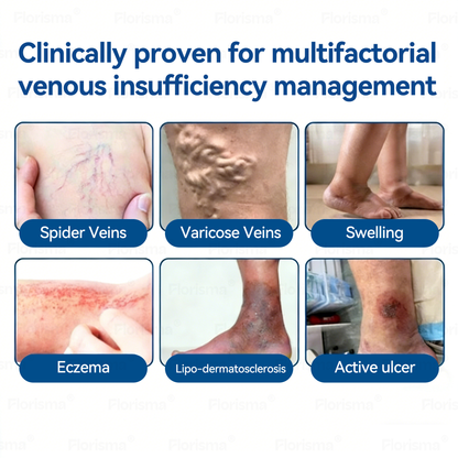 One Patch a Day. Visible Vein Relief in Just 7 Days 👨‍⚕️ 𝑭𝑳𝑶𝑹𝑰𝑺𝑴𝑨® 𝑫𝑰𝑶𝑺𝑴𝑰𝑵 & 𝑯𝑬𝑺𝑷𝑬𝑹𝑰𝑫𝑰𝑵 𝑪𝒍𝒊𝒏𝒊𝒄𝒂𝒍-𝑮𝒓𝒂𝒅𝒆 𝑭𝒐𝒓𝒎𝒖𝒍𝒂 𝑴𝒊𝒄𝒓𝒐𝒏𝒆𝒆𝒅𝒍𝒆 𝑷𝒂𝒕𝒄𝒉 ⚡ 𝗔𝗱𝘃𝗮𝗻𝗰𝗲𝗱 𝗛𝗲𝗿𝗯𝗮𝗹 𝗕𝗹𝗲𝗻𝗱 𝗧𝗮𝗿𝗴𝗲𝘁𝘀 𝗦𝗽𝗶𝗱𝗲𝗿 𝗩𝗲𝗶𝗻𝘀 & 𝗥𝗲𝗹𝗶𝗲𝘃𝗲𝘀 𝗛𝗲𝗮𝘃𝘆, 𝗧𝗶𝗿𝗲𝗱 𝗟𝗲𝗴𝘀