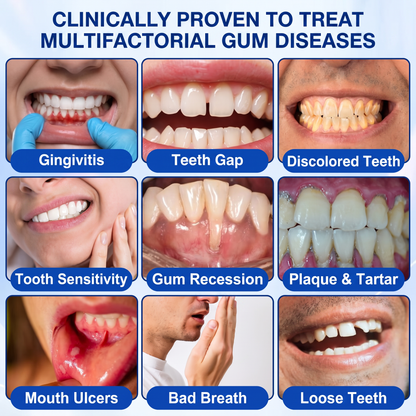 Glimmerly®🎋GumRevive periodontal repair gel🌴