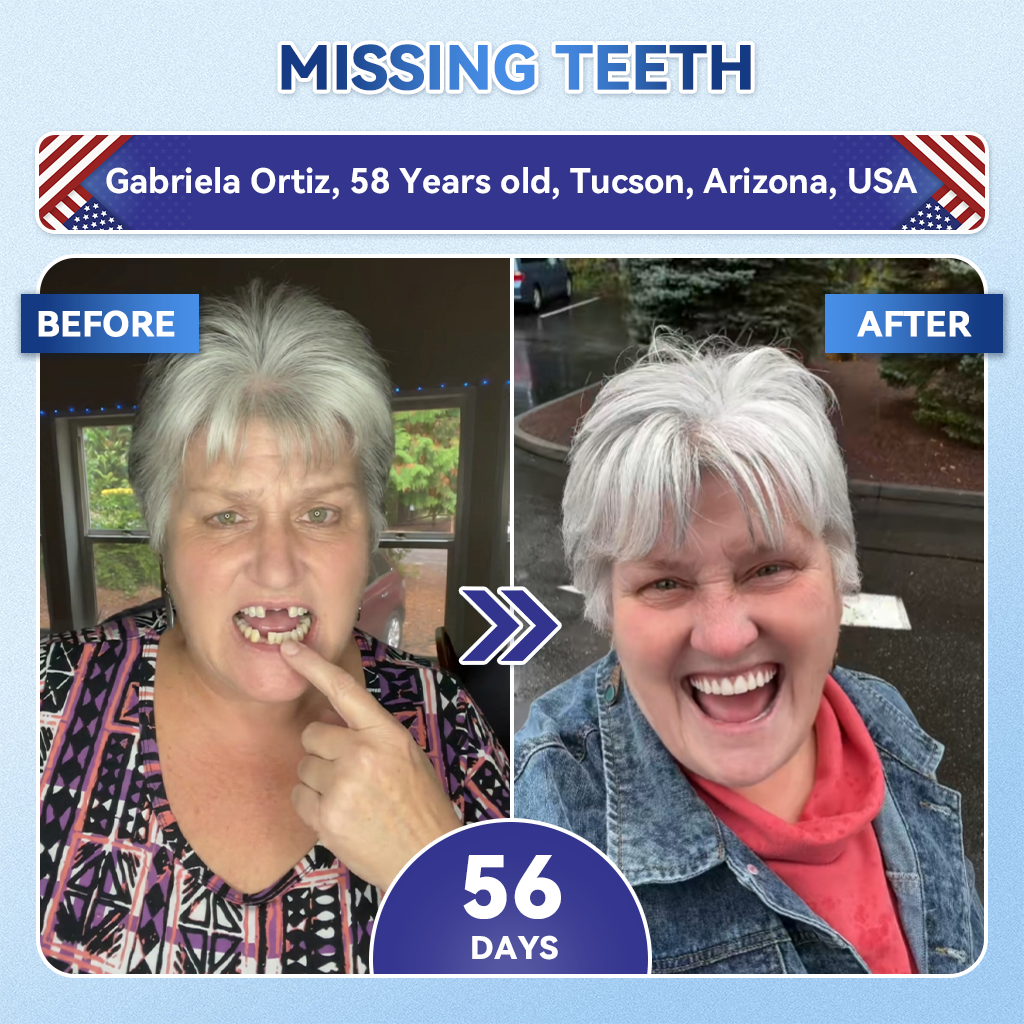 【Flagship store🗽】Glimmerly®  Tideglusib Fast‑Dissolving Tooth & Gum Repair Oral Strips  (Supports tooth repair and helps relieve gum discomfort and other common oral concerns)
