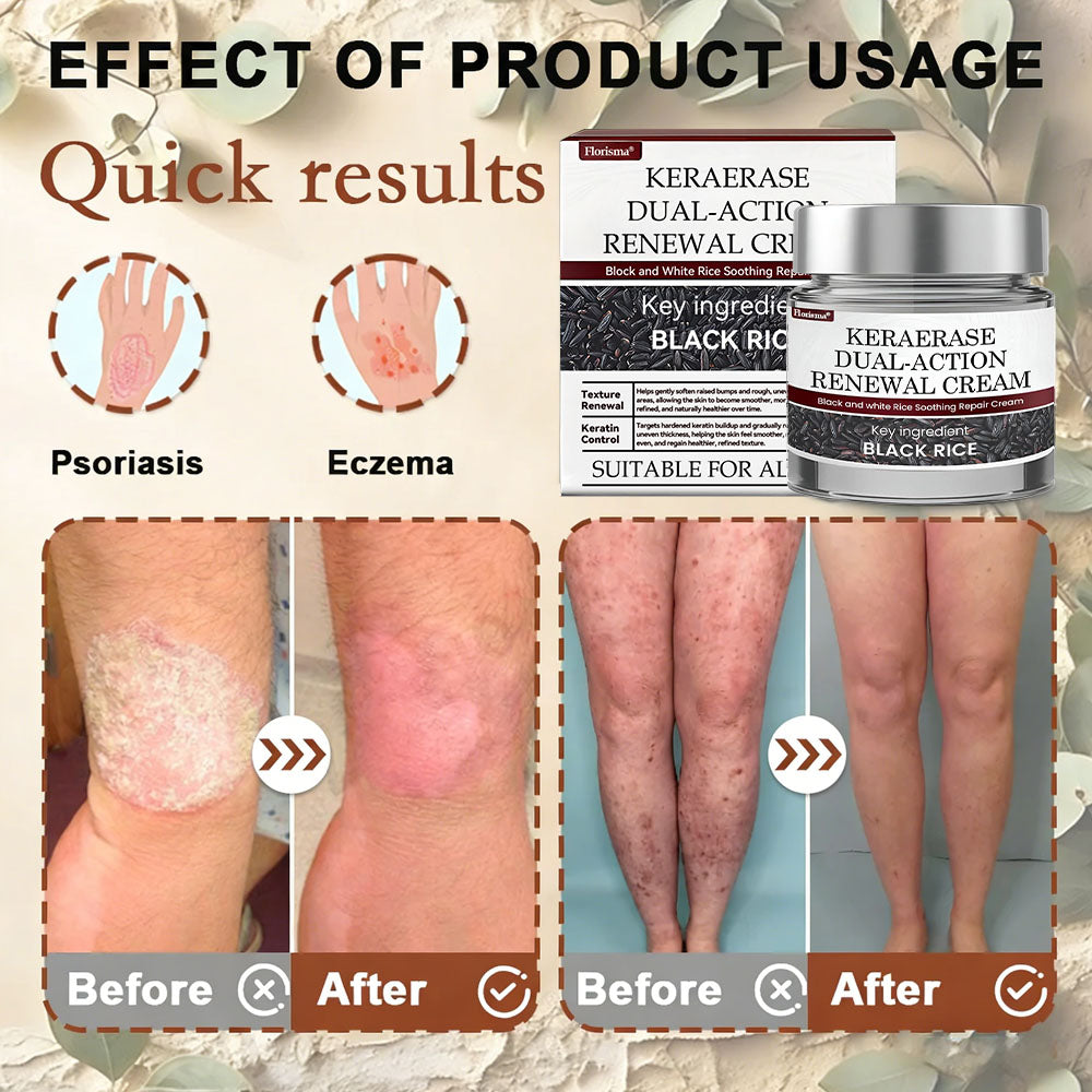 Florisma® 👩‍⚕️(removes warts and skin growths, senile purpura, cherry angiomas, skin cancer, and seborrheic keratoses)🍃