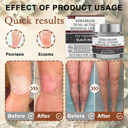 Florisma® 👩‍⚕️(removes warts and skin growths, senile purpura, cherry angiomas, skin cancer, and seborrheic keratoses)🍃