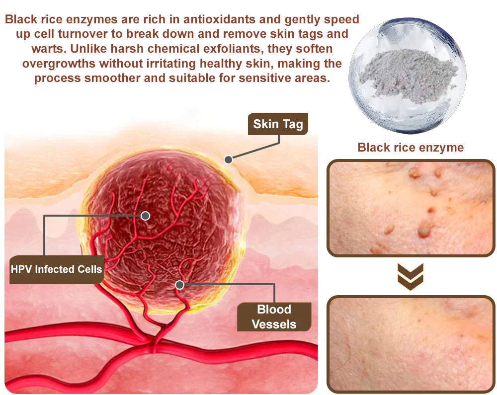 Florisma® 👩‍⚕️(removes warts and skin growths, senile purpura, cherry angiomas, skin cancer, and seborrheic keratoses)🍃