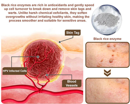 Florisma® 👩‍⚕️(removes warts and skin growths, senile purpura, cherry angiomas, skin cancer, and seborrheic keratoses)🍃