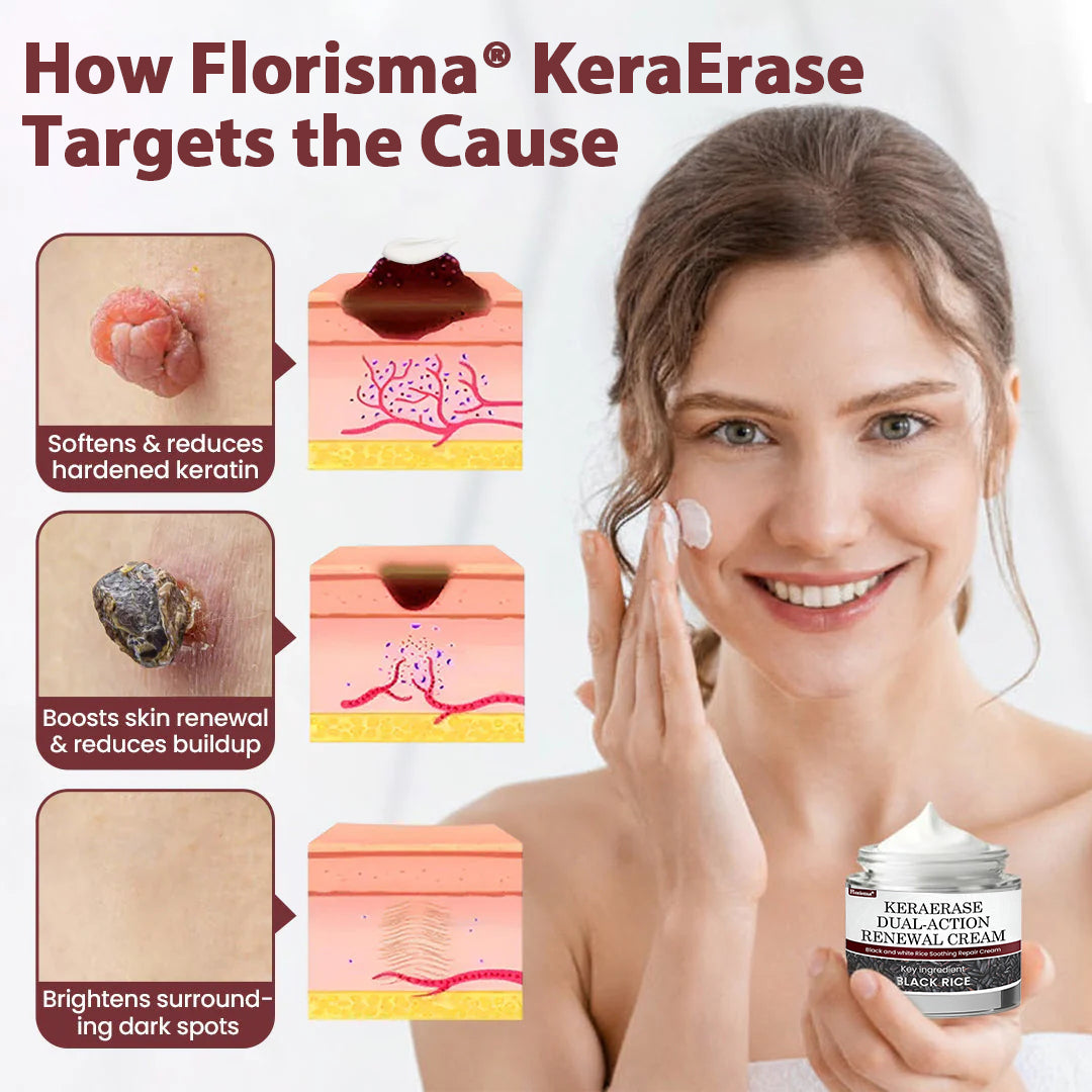 Florisma® KeraErase Dual-Action Renewal Cream 💎 Discover smooth, clear, and even-looking skin again with a gentle, botanical formula that targets and renews skin irregularities, skin tags, and keratin buildup without irritation👨‍🔬