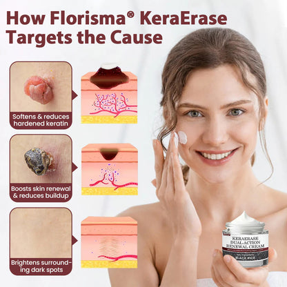 Florisma® KeraErase Dual-Action Renewal Cream 💎 Discover smooth, clear, and even-looking skin again with a gentle, botanical formula that targets and renews skin irregularities, skin tags, and keratin buildup without irritation👨‍🔬