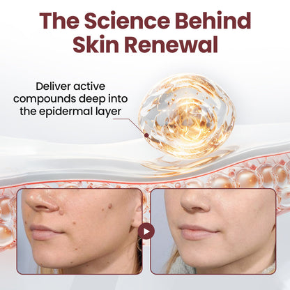 Florisma® KeraErase Dual-Action Renewal Cream 💎 Discover smooth, clear, and even-looking skin again with a gentle, botanical formula that targets and renews skin irregularities, skin tags, and keratin buildup without irritation👨‍🔬