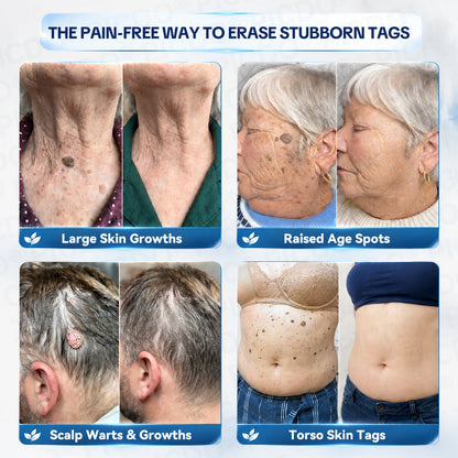 𝐏𝐡𝐚𝐫𝐦𝐚𝐜𝐢𝐬𝐭 𝐑𝐞𝐜𝐨𝐦𝐦𝐞𝐧𝐝𝐞𝐝🥇𝐏𝐢𝐜𝐝𝐨® 7-𝐃𝐚𝐲 𝐒𝐤𝐢𝐧 𝐓𝐚𝐠 & 𝐒𝐩𝐨𝐭 𝐄𝐫𝐚𝐬𝐞𝐫 𝐂𝐫𝐞𝐚𝐦 🌻(Zero Pain, Zero 𝐒𝐜𝐚𝐫𝐬 Formula)
