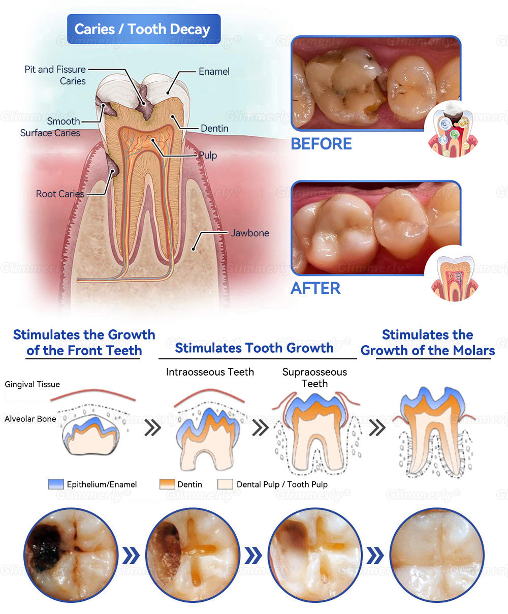 Glimmerly® Stem Cell Gingival Repair Mousse 🦷 Tooth Enamel Regeneration • Tartar Dissolver • Gum Strengthener • Deep-Clean Foaming Formula