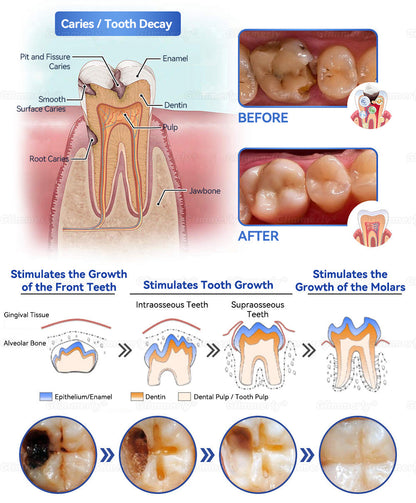 Glimmerly® Stem Cell Gingival Repair Mousse 🦷 Tooth Enamel Regeneration • Tartar Dissolver • Gum Strengthener • Deep-Clean Foaming Formula