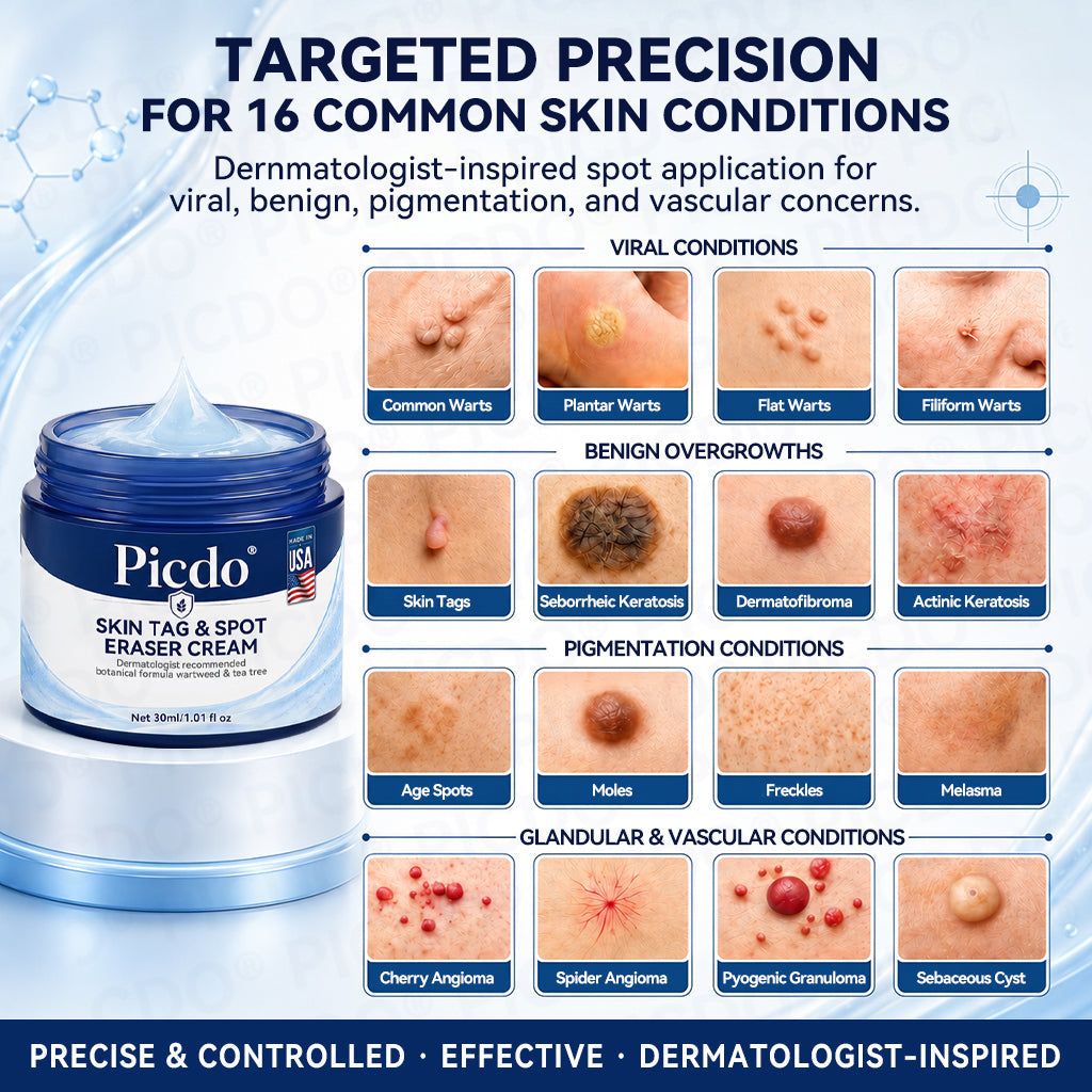 𝐏𝐡𝐚𝐫𝐦𝐚𝐜𝐢𝐬𝐭 𝐑𝐞𝐜𝐨𝐦𝐦𝐞𝐧𝐝𝐞𝐝🥇𝐏𝐢𝐜𝐝𝐨® 7-𝐃𝐚𝐲 𝐒𝐤𝐢𝐧 𝐓𝐚𝐠 & 𝐒𝐩𝐨𝐭 𝐄𝐫𝐚𝐬𝐞𝐫 𝐂𝐫𝐞𝐚𝐦 🌻(Zero Pain, Zero 𝐒𝐜𝐚𝐫𝐬 Formula)