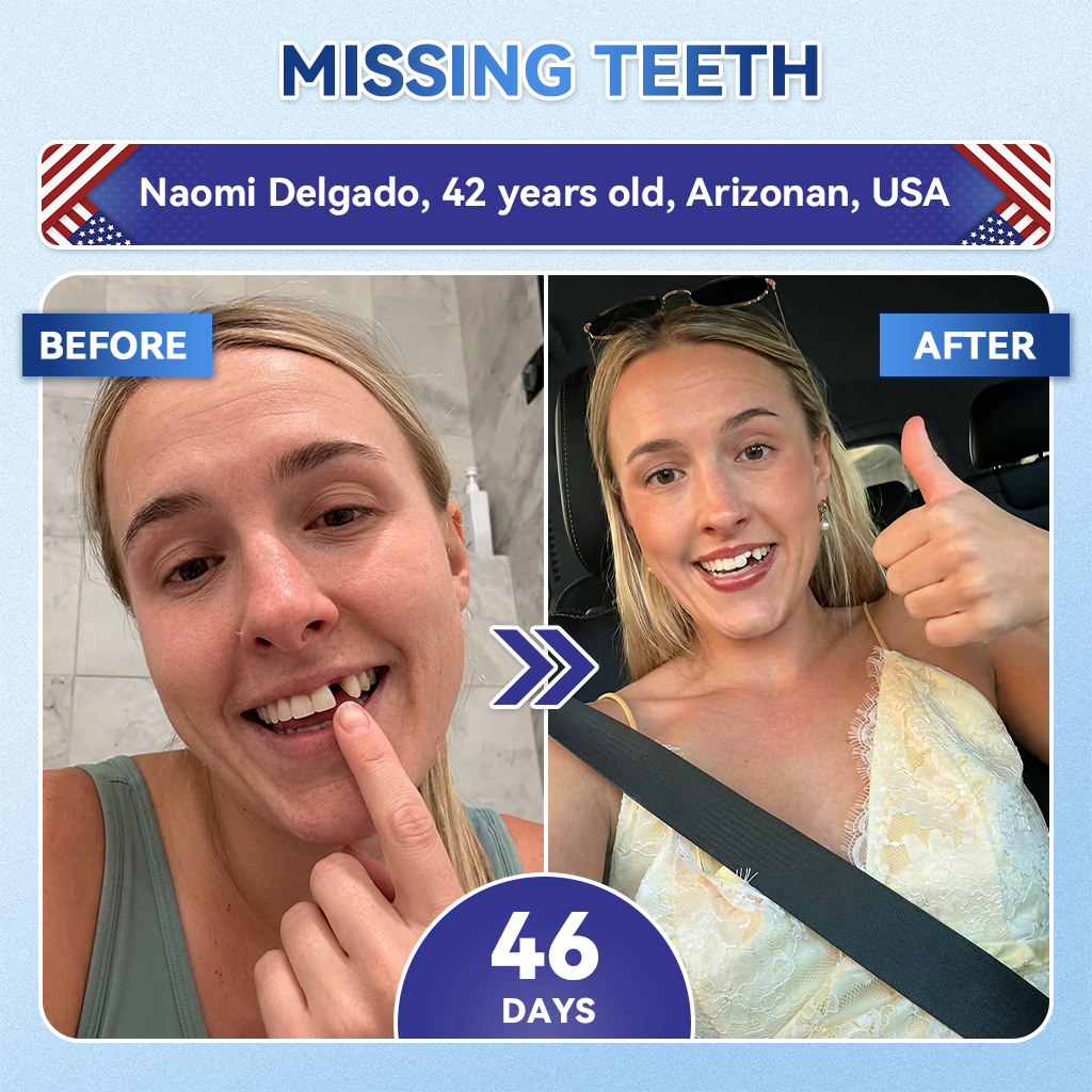 【Flagship store🗽】Glimmerly®  Tideglusib Fast‑Dissolving Tooth & Gum Repair Oral Strips  (Supports tooth repair and helps relieve gum discomfort and other common oral concerns)