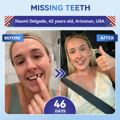 Smile instantly 🦷 𝐆𝐥𝐢𝐦𝐦𝐞𝐫𝐥𝐲® 𝐓𝐢𝐝𝐞𝐠𝐥𝐮𝐬𝐢𝐛 𝐓𝐨𝐨𝐭𝐡 & 𝐆𝐮𝐦 𝐑𝐞𝐩𝐚𝐢𝐫 𝐌𝐢𝐜𝐫𝐨𝐧𝐞𝐞𝐝𝐥𝐞 𝐏𝐚𝐭𝐜𝐡  | 𝐀𝐝𝐯𝐚𝐧𝐜𝐞𝐝 𝐒𝐭𝐞𝐦-𝐂𝐞𝐥𝐥 𝐀𝐜𝐭𝐢𝐯𝐚𝐭𝐢𝐨𝐧 𝐓𝐞𝐞𝐭𝐡 𝐒𝐭𝐫𝐢𝐩𝐬(🦷𝐑𝐞𝐛𝐮𝐢𝐥𝐝 𝐄𝐧𝐚𝐦𝐞𝐥 & 𝐃𝐞𝐧𝐭𝐢𝐧 • 𝐒𝐭𝐫𝐞𝐧𝐠𝐭𝐡𝐞𝐧 𝐆𝐮𝐦𝐬 • 𝐄𝐫𝐚𝐝𝐢𝐜𝐚𝐭𝐞 𝐓𝐚𝐫𝐭𝐚𝐫 & 𝐎𝐝𝐨𝐫 • 𝐒𝐭𝐨𝐩 𝐓𝐨𝐨𝐭𝐡 𝐒𝐞𝐧𝐬𝐢𝐭𝐢𝐯𝐢𝐭𝐲)