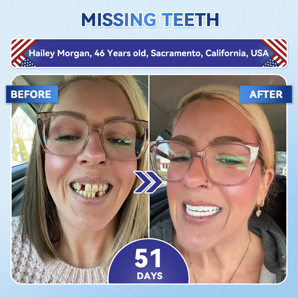 Smile instantly 🦷 𝐆𝐥𝐢𝐦𝐦𝐞𝐫𝐥𝐲® 𝐓𝐢𝐝𝐞𝐠𝐥𝐮𝐬𝐢𝐛 𝐓𝐨𝐨𝐭𝐡 & 𝐆𝐮𝐦 𝐑𝐞𝐩𝐚𝐢𝐫 𝐌𝐢𝐜𝐫𝐨𝐧𝐞𝐞𝐝𝐥𝐞 𝐏𝐚𝐭𝐜𝐡  | 𝐀𝐝𝐯𝐚𝐧𝐜𝐞𝐝 𝐒𝐭𝐞𝐦-𝐂𝐞𝐥𝐥 𝐀𝐜𝐭𝐢𝐯𝐚𝐭𝐢𝐨𝐧 𝐓𝐞𝐞𝐭𝐡 𝐒𝐭𝐫𝐢𝐩𝐬(🦷𝐑𝐞𝐛𝐮𝐢𝐥𝐝 𝐄𝐧𝐚𝐦𝐞𝐥 & 𝐃𝐞𝐧𝐭𝐢𝐧 • 𝐒𝐭𝐫𝐞𝐧𝐠𝐭𝐡𝐞𝐧 𝐆𝐮𝐦𝐬 • 𝐄𝐫𝐚𝐝𝐢𝐜𝐚𝐭𝐞 𝐓𝐚𝐫𝐭𝐚𝐫 & 𝐎𝐝𝐨𝐫 • 𝐒𝐭𝐨𝐩 𝐓𝐨𝐨𝐭𝐡 𝐒𝐞𝐧𝐬𝐢𝐭𝐢𝐯𝐢𝐭𝐲)