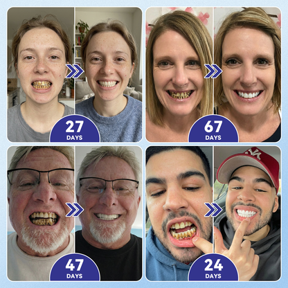 【Celebrity-favorite teeth patches 】🦷𝐆𝐥𝐢𝐦𝐦𝐞𝐫𝐥𝐲® 𝐓𝐢𝐝𝐞𝐠𝐥𝐮𝐬𝐢𝐛 𝐓𝐨𝐨𝐭𝐡 & 𝐆𝐮𝐦 𝐑𝐞𝐩𝐚𝐢𝐫 𝐌𝐢𝐜𝐫𝐨𝐧𝐞𝐞𝐝𝐥𝐞 𝐏𝐚𝐭𝐜𝐡  | 𝐀𝐝𝐯𝐚𝐧𝐜𝐞𝐝 𝐒𝐭𝐞𝐦-𝐂𝐞𝐥𝐥 𝐀𝐜𝐭𝐢𝐯𝐚𝐭𝐢𝐨𝐧 𝐓𝐞𝐞𝐭𝐡 𝐒𝐭𝐫𝐢𝐩𝐬(🦷𝐑𝐞𝐛𝐮𝐢𝐥𝐝 𝐄𝐧𝐚𝐦𝐞𝐥 & 𝐃𝐞𝐧𝐭𝐢𝐧 • 𝐒𝐭𝐫𝐞𝐧𝐠𝐭𝐡𝐞𝐧 𝐆𝐮𝐦𝐬 • 𝐄𝐫𝐚𝐝𝐢𝐜𝐚𝐭𝐞 𝐓𝐚𝐫𝐭𝐚𝐫 & 𝐎𝐝𝐨𝐫 • 𝐒𝐭𝐨𝐩 𝐓𝐨𝐨𝐭𝐡 𝐒𝐞𝐧𝐬𝐢𝐭𝐢𝐯𝐢𝐭𝐲)