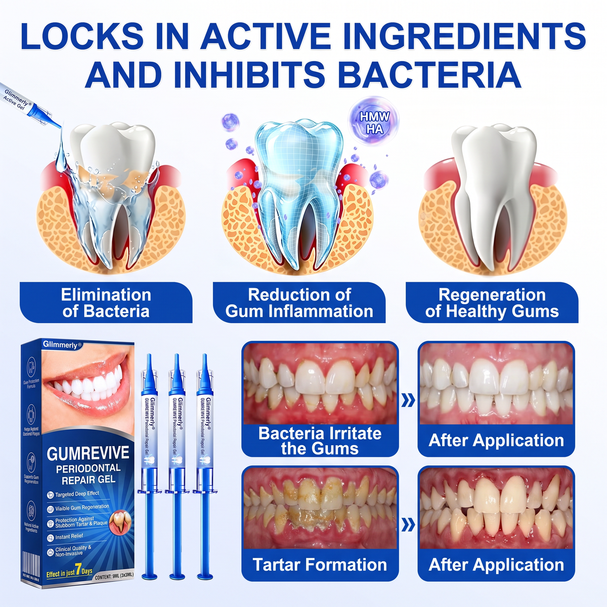 🇺🇸𝑮𝒍𝒊𝒎𝒎𝒆𝒓𝒍𝒚® 🦷𝑮𝒖𝒎𝑹𝒆𝒗𝒊𝒗𝒆 𝒑𝒆𝒓𝒊𝒐𝒅𝒐𝒏𝒕𝒂𝒍 𝒓𝒆𝒑𝒂𝒊𝒓 𝒈𝒆𝒍🍀