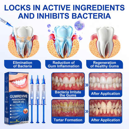 Glimmerly®🎋GumRevive periodontal repair gel🌴