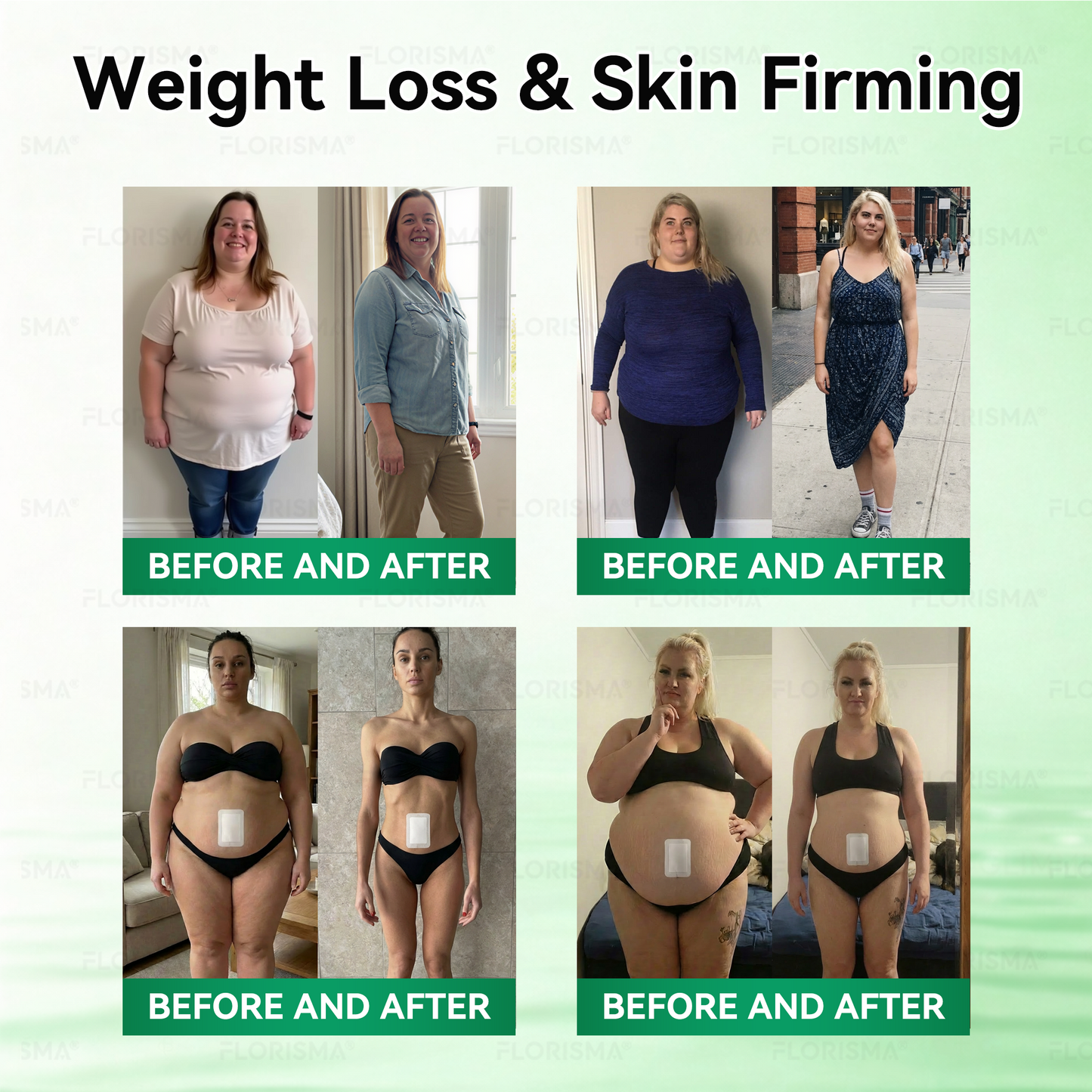 Once Daily, Visible Changes in 7 Days 👨‍🔬 𝐹𝑙𝑜𝑟𝑖𝑠𝑚𝑎® 𝐵𝑟𝑜𝑤𝑛 𝐹𝑎𝑡 𝑇𝑎𝑟𝑔𝑒𝑡𝑒𝑑 𝐹𝑎𝑡-𝐵𝑢𝑟𝑛𝑖𝑛𝑔 𝑃𝑎𝑡𝑐ℎ 🏆 Addresses obesity, diabetes, sleep apnea, lymphatic detoxification, and joint issues.