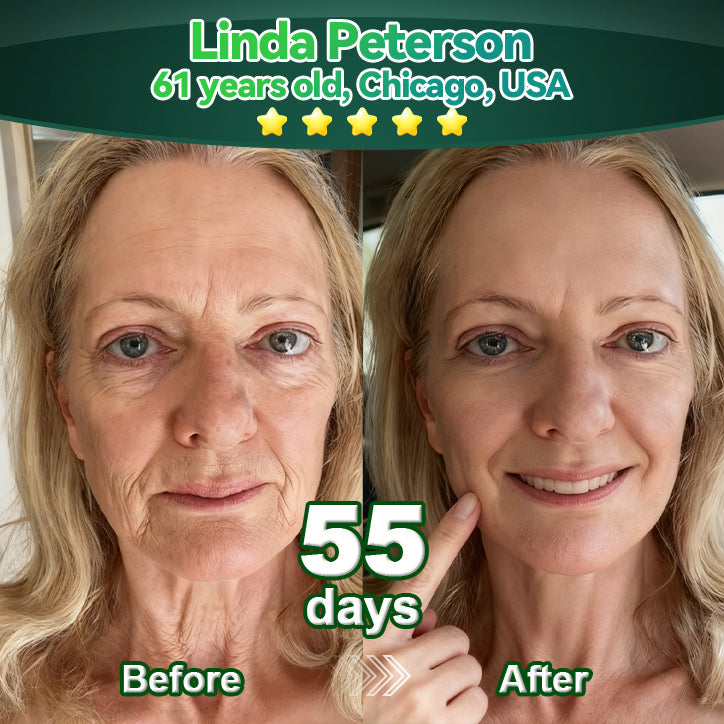 Make your skin more refined and stable 🪁 Luxarise® Plant-Derived Cellular Support Complex Serum (Lift & Firm Sagging Skin & Reduce Wrinkle Formation) 🧩