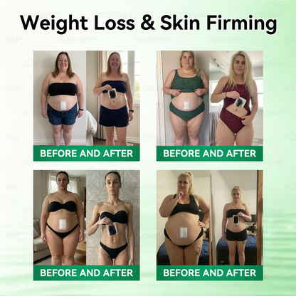 Once Daily, Visible Changes in 7 Days 👨‍🔬 𝐹𝑙𝑜𝑟𝑖𝑠𝑚𝑎® 𝐵𝑟𝑜𝑤𝑛 𝐹𝑎𝑡 𝑇𝑎𝑟𝑔𝑒𝑡𝑒𝑑 𝐹𝑎𝑡-𝐵𝑢𝑟𝑛𝑖𝑛𝑔 𝑃𝑎𝑡𝑐ℎ 🌻 Addresses obesity, diabetes, sleep apnea, lymphatic detoxification, and joint issues