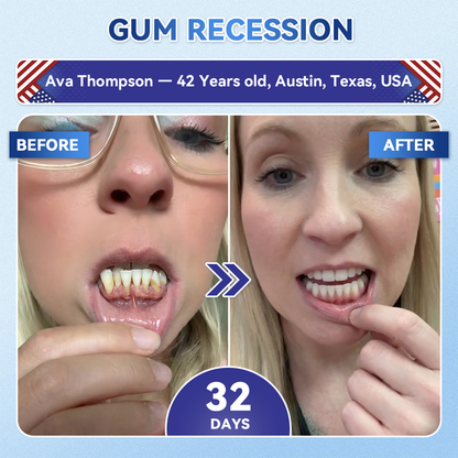 Smile instantly 🦷 𝐆𝐥𝐢𝐦𝐦𝐞𝐫𝐥𝐲® 𝐓𝐢𝐝𝐞𝐠𝐥𝐮𝐬𝐢𝐛 𝐓𝐨𝐨𝐭𝐡 & 𝐆𝐮𝐦 𝐑𝐞𝐩𝐚𝐢𝐫 𝐌𝐢𝐜𝐫𝐨𝐧𝐞𝐞𝐝𝐥𝐞 𝐏𝐚𝐭𝐜𝐡  | 𝐀𝐝𝐯𝐚𝐧𝐜𝐞𝐝 𝐒𝐭𝐞𝐦-𝐂𝐞𝐥𝐥 𝐀𝐜𝐭𝐢𝐯𝐚𝐭𝐢𝐨𝐧 𝐓𝐞𝐞𝐭𝐡 𝐒𝐭𝐫𝐢𝐩𝐬(🦷𝐑𝐞𝐛𝐮𝐢𝐥𝐝 𝐄𝐧𝐚𝐦𝐞𝐥 & 𝐃𝐞𝐧𝐭𝐢𝐧 • 𝐒𝐭𝐫𝐞𝐧𝐠𝐭𝐡𝐞𝐧 𝐆𝐮𝐦𝐬 • 𝐄𝐫𝐚𝐝𝐢𝐜𝐚𝐭𝐞 𝐓𝐚𝐫𝐭𝐚𝐫 & 𝐎𝐝𝐨𝐫 • 𝐒𝐭𝐨𝐩 𝐓𝐨𝐨𝐭𝐡 𝐒𝐞𝐧𝐬𝐢𝐭𝐢𝐯𝐢𝐭𝐲)